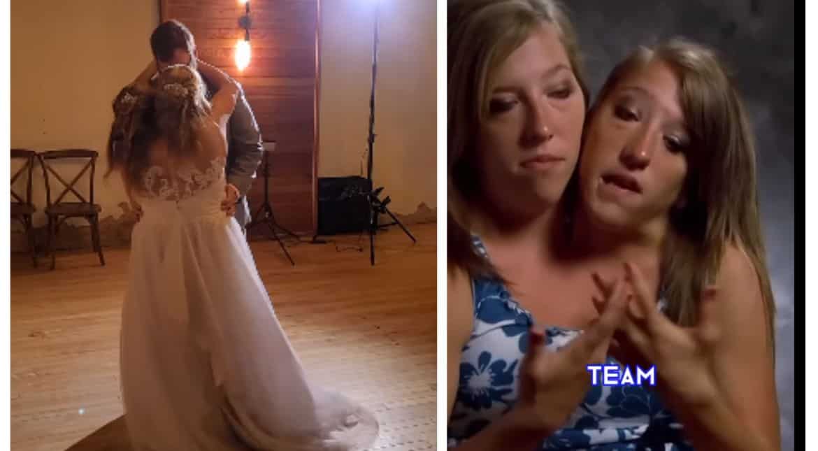 Abby, one of two conjoined twins and reality TV star, married beau in a secret ceremony