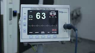 This new AI model will predict cardiac irregularity 30 minutes before its onset