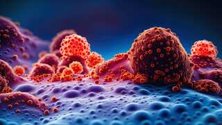Can vaccines prevent cancer? World's first lung cancer vaccine trials will have answers