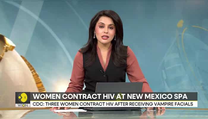 3 women contract HIV after getting ‘vampire facial’ at New Mexico spa