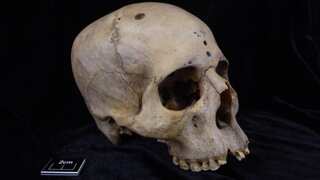 Ancient Egyptian skulls reveal 4,000-year-old cancer treatments, study finds