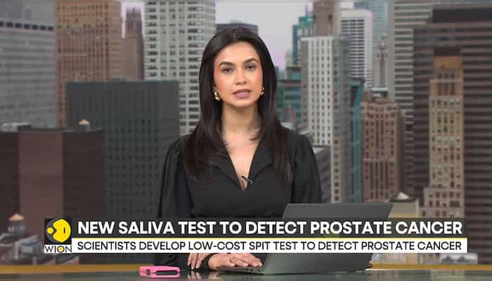 Scientists develop low-cost spit test to detect Prostate Cancer