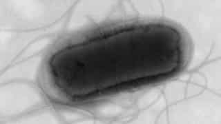 Health crisis in UK: Over 100 ill following E coli outbreak, says UKHSA