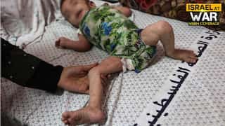 Israel-Hamas conflict: Children in Gaza hit hard by dangerous skin diseases amid prolonged war