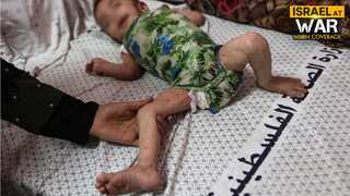 Israel-Hamas conflict: Children in Gaza hit hard by dangerous skin diseases amid prolonged war