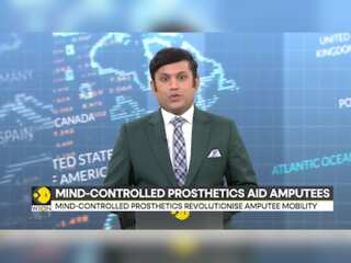New surgery enhances prosthetic limb control
