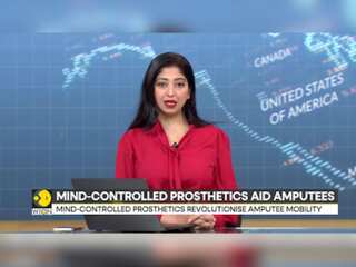 New surgery links brain to prosthetics for natural movement