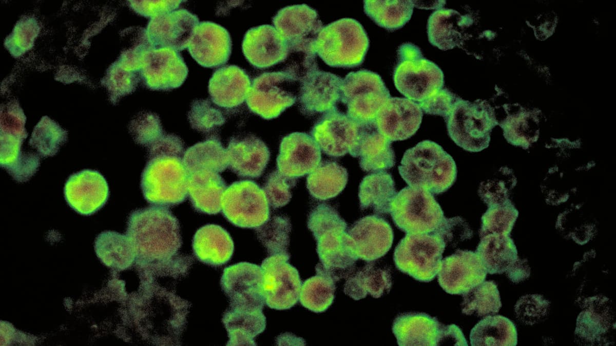 Deadly brain-eating amoeba kills Indian boy. Here's what it is and how it infects people