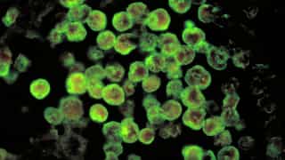 Deadly brain-eating amoeba kills Indian boy. Here's what it is and how it infects people