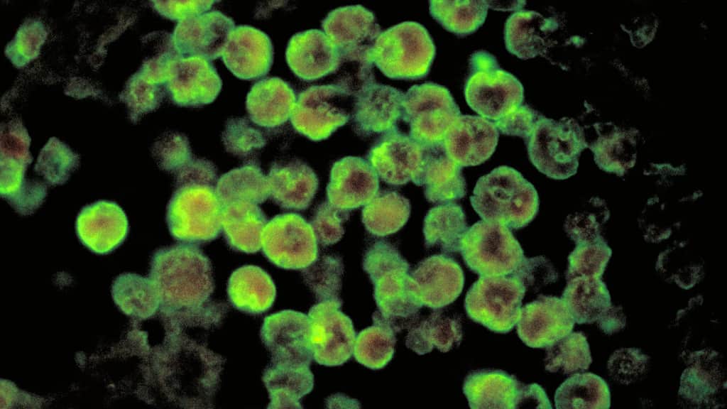 Deadly brain-eating amoeba kills Indian boy. Here's what it is and how it infects people