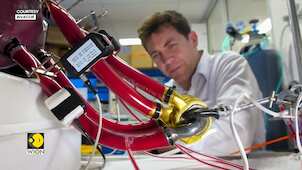 Metal heart made of titanium successfully implanted