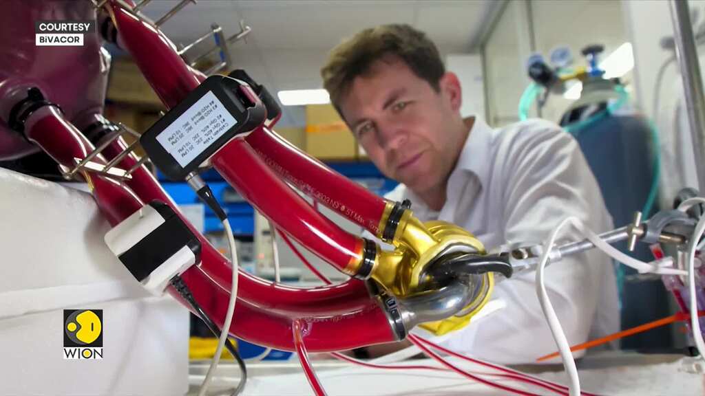 Metal heart made of titanium successfully implanted
