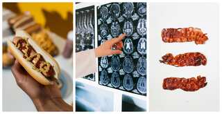 Do you love your bacon? Eating processed red meat can add to your dementia risk, suggests large study