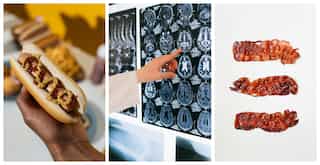 Do you love your bacon? Eating processed red meat can add to your dementia risk, suggests large study