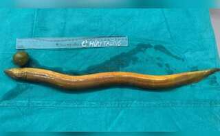 Indian man almost dies after inserting 65cm long eel up his anus to 'seek sensations'