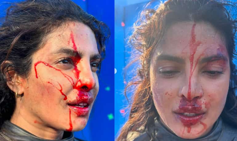 Blood and bruises! Priyanka Chopra shares intense look from The Bluff set