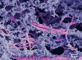 This biomaterial can repair and regenerate cartilage tissue. End in sight for knee replacement surgeries?