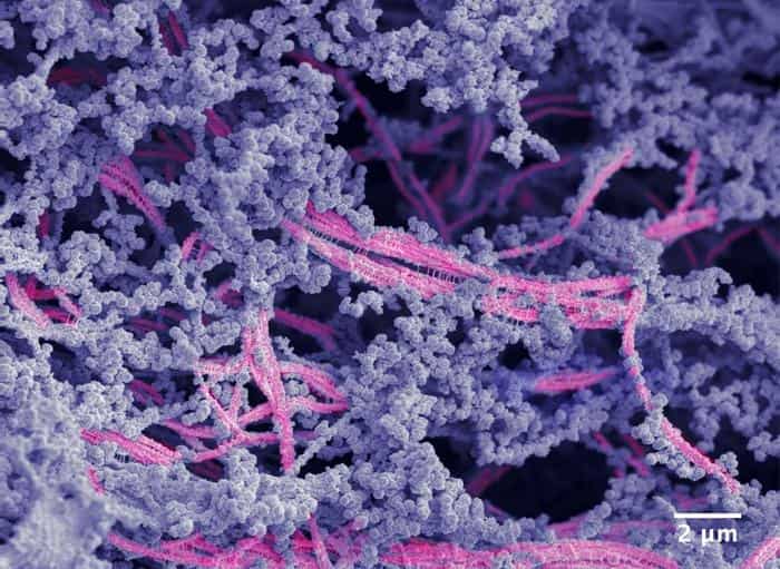 This biomaterial can repair and regenerate cartilage tissue. End in sight for knee replacement surgeries?
