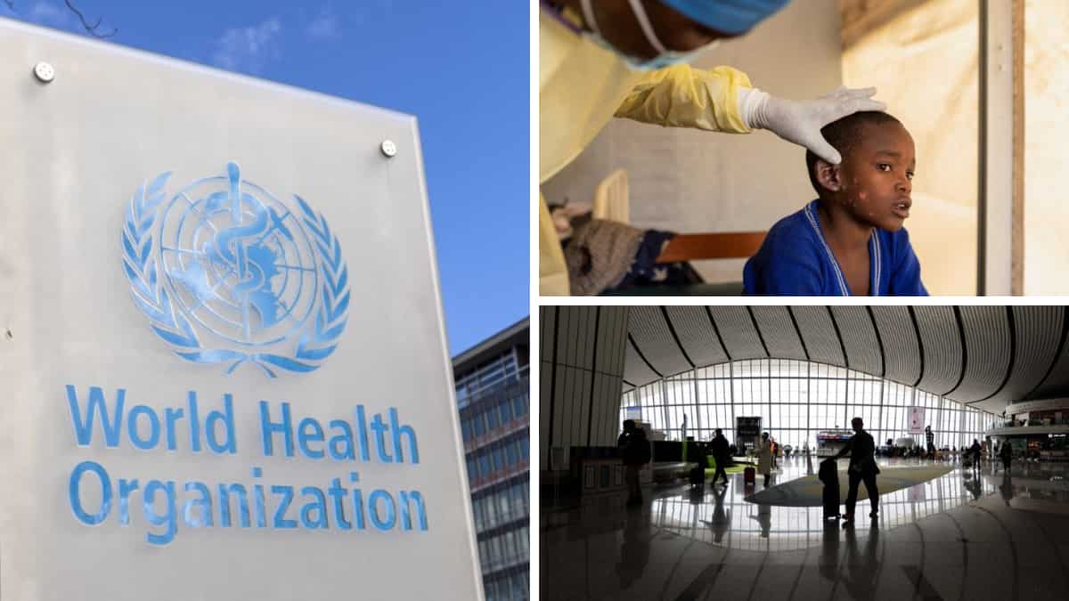 Mpox crisis: Pakistan detects three cases, China to monitor arrivals of people, goods| Top updates