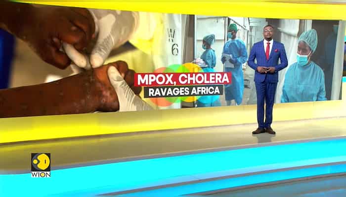 Mpox and cholera ravage Africa concurrently