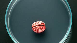 Human blood-based mini-brains may revolutionise treatment of Alzheimer’s: Scientist