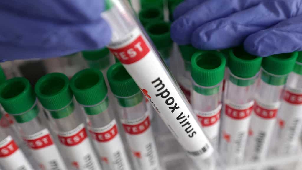 Mpox crisis: Africa to finally receive its first batch of vaccines against virus