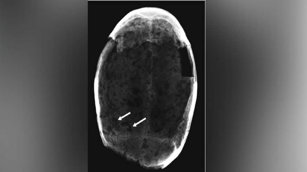 Were Italians consuming cocaine in 17th century to curb hunger and thirst? Study says...