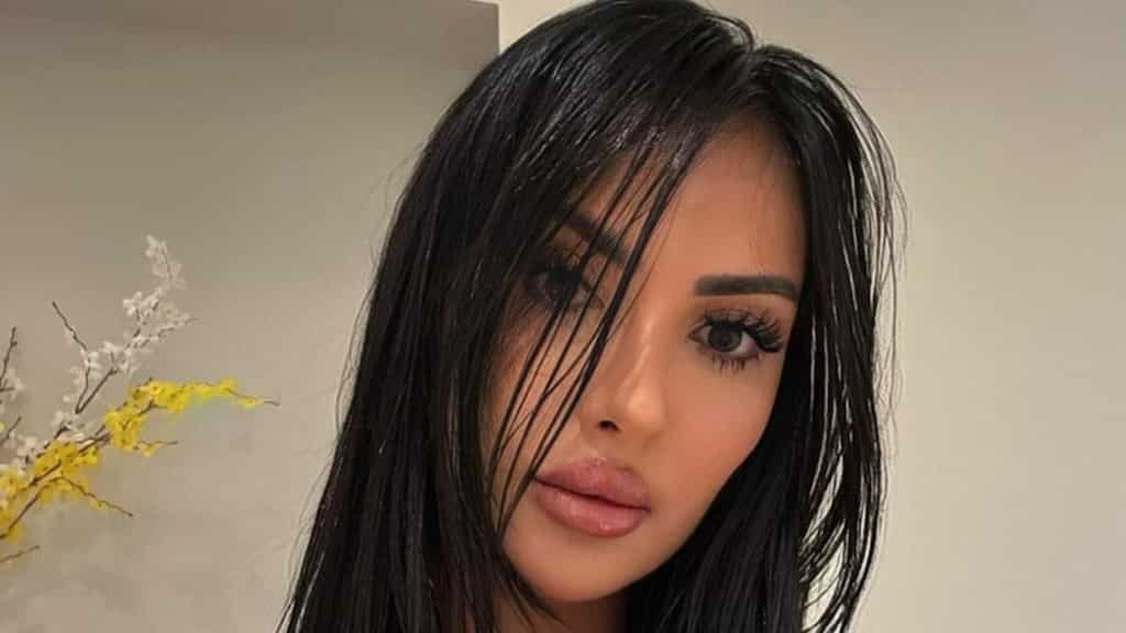 ‘Surgery addict’ influencer tried to look like Kim Kardashian, turned infertile after butt filler