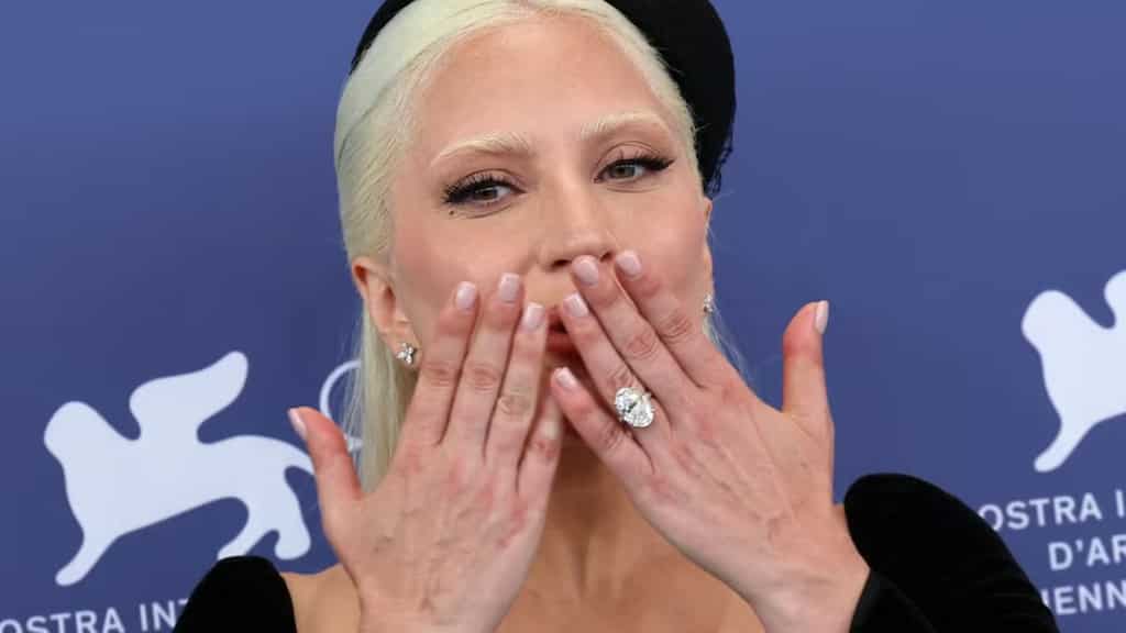 Check out Lady Gaga's new electric pop single, Disease