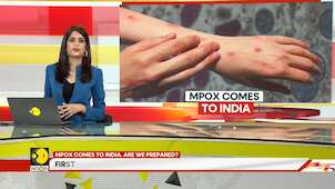 Mpox comes to India. Are we prepared?