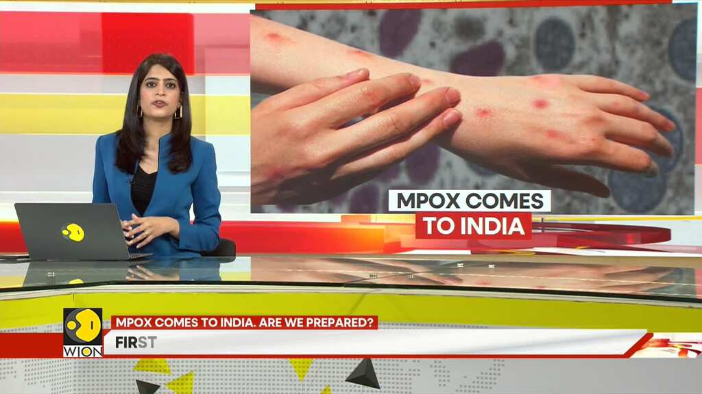 Mpox comes to India. Are we prepared?