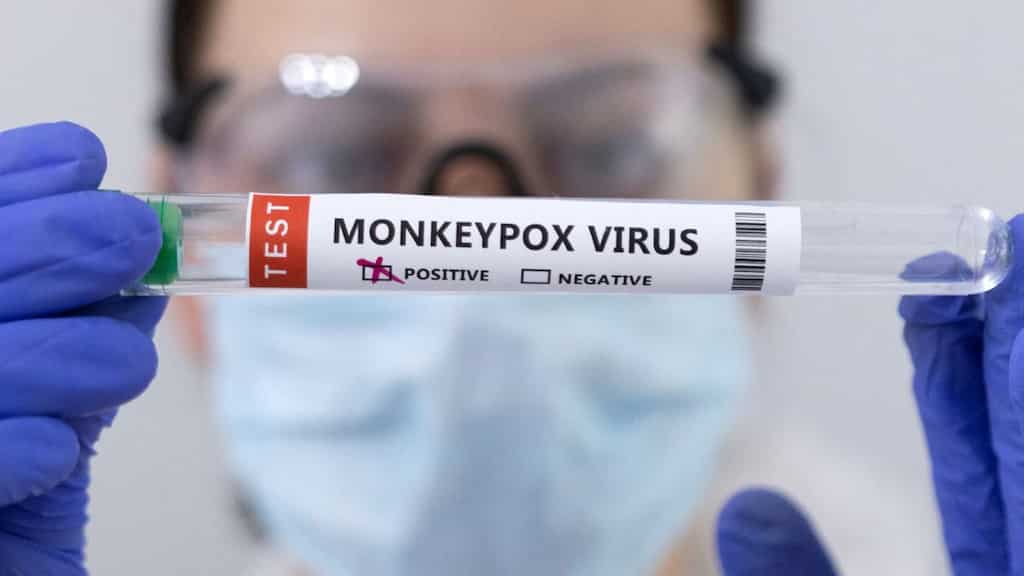 India: First case of mpox Clade 1b strain detected in Kerala