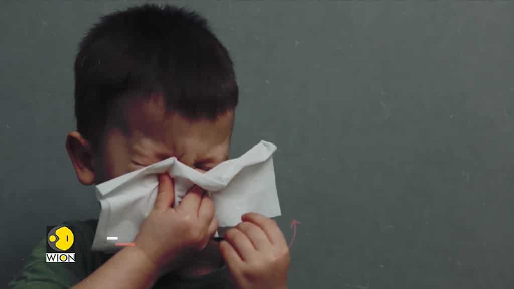 Virus Linked To Childhood Paralysis On The Rise In The US