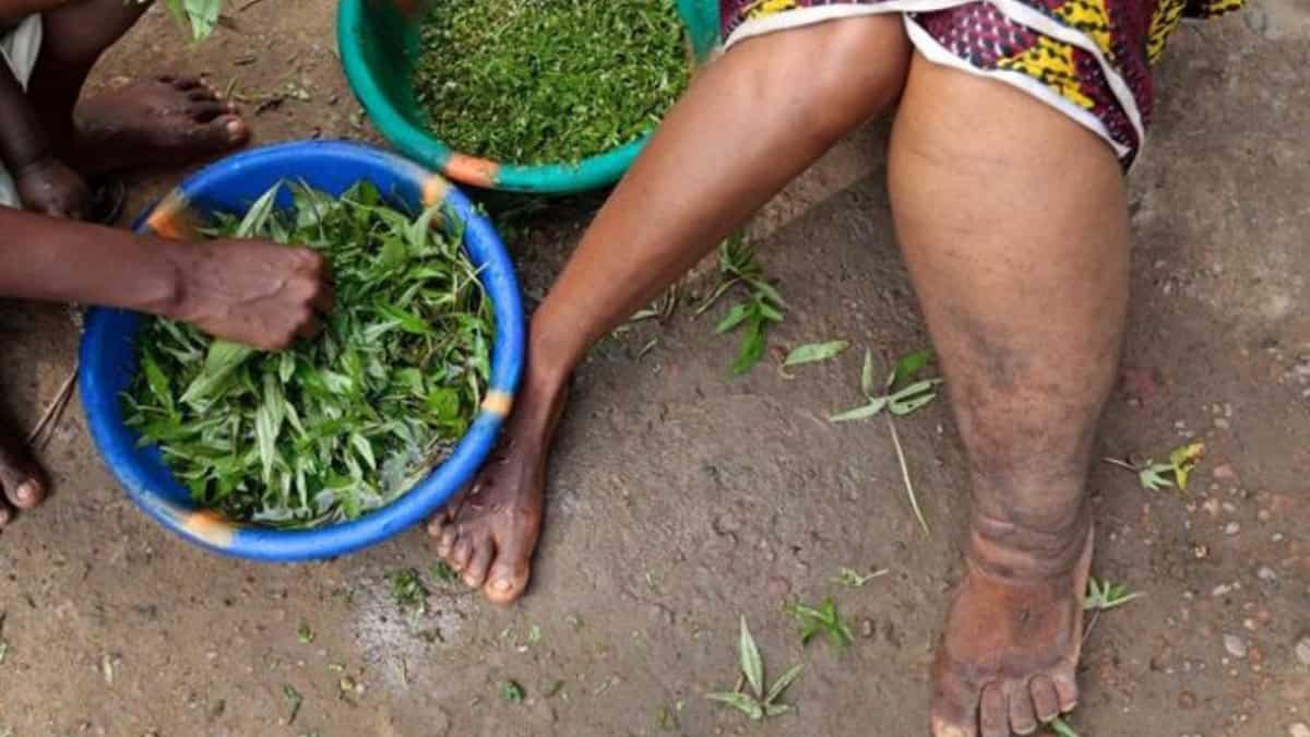 India's fight against Lymphatic Filariasis through a community-driven approach