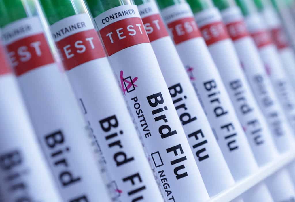 Canada detects first human case of H5 bird flu in British Columbia teen