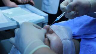 Woman dies after getting multiple laser treatments to remove birthmarks and spots in China