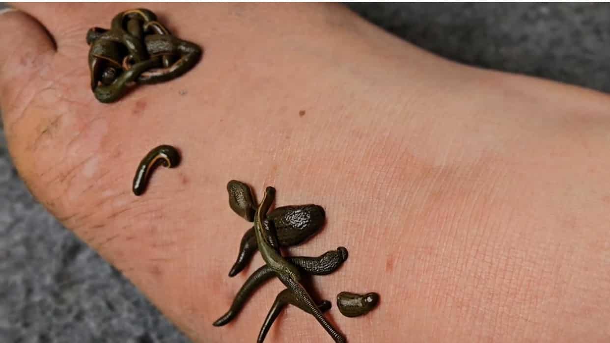 Leeches