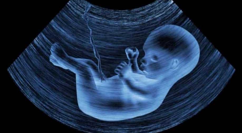 Microplastics found in the placentas of unborn babies for first time 1