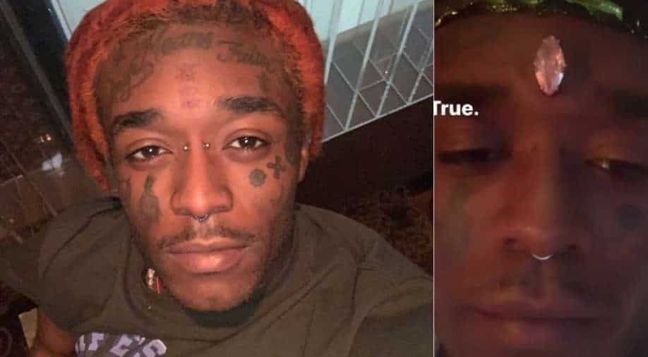 Rapper Lil Uzi Vert gets a diamond implant on his forehead like Marvel's Vision, Entertainment ...