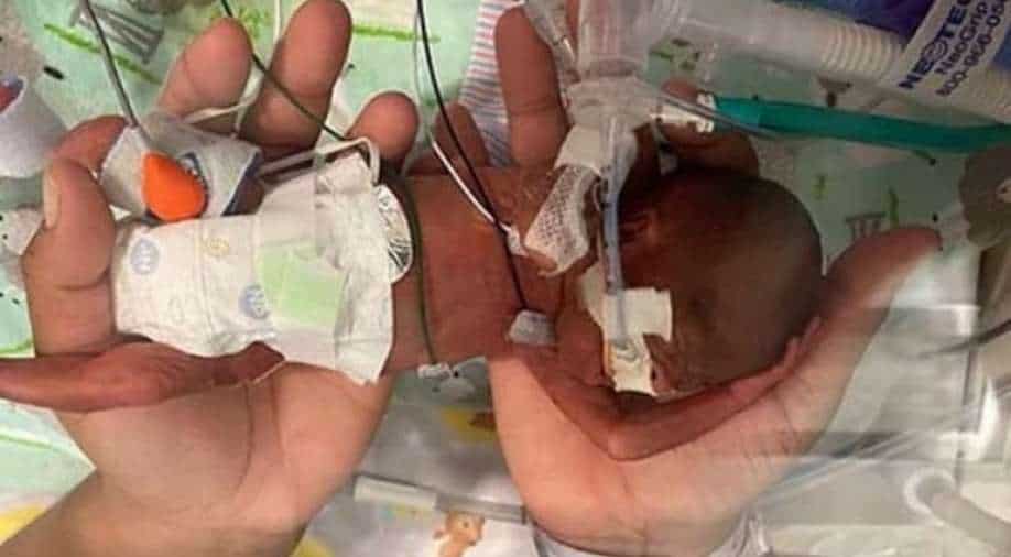 Earliest a premature sales baby can survive