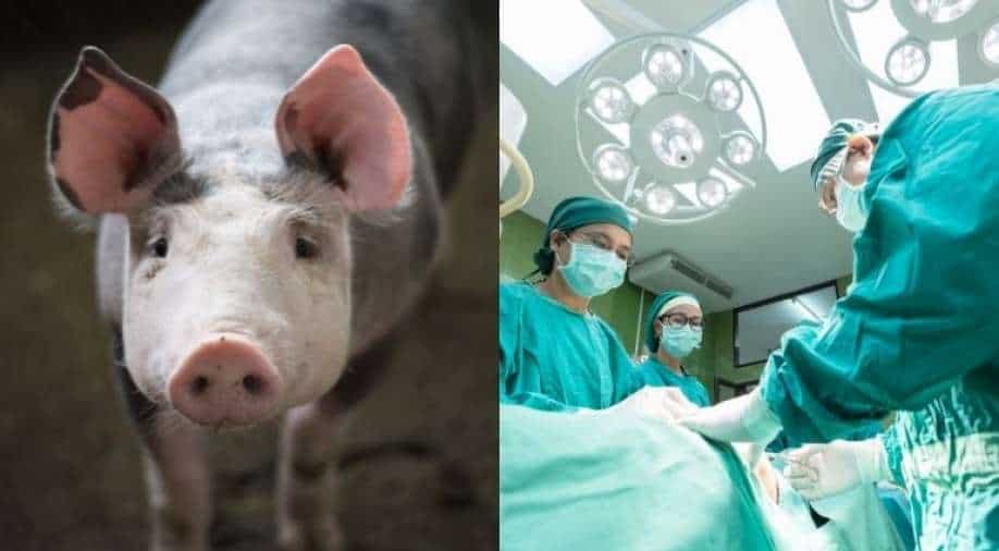 Explainer Xenotransplantation Will animaltohuman organ transplant