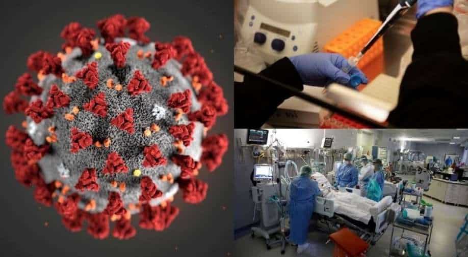 Covid infection raises risk of developing fatal blood clot in lung by 33-fold, says study - Vimarsana News