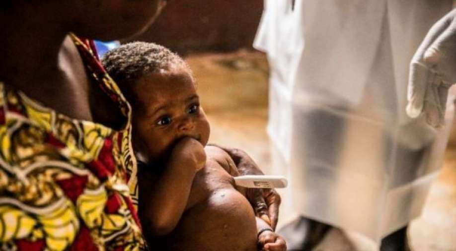 Monkeypox cases reported in Germany, France, Belgium - Vimarsana News