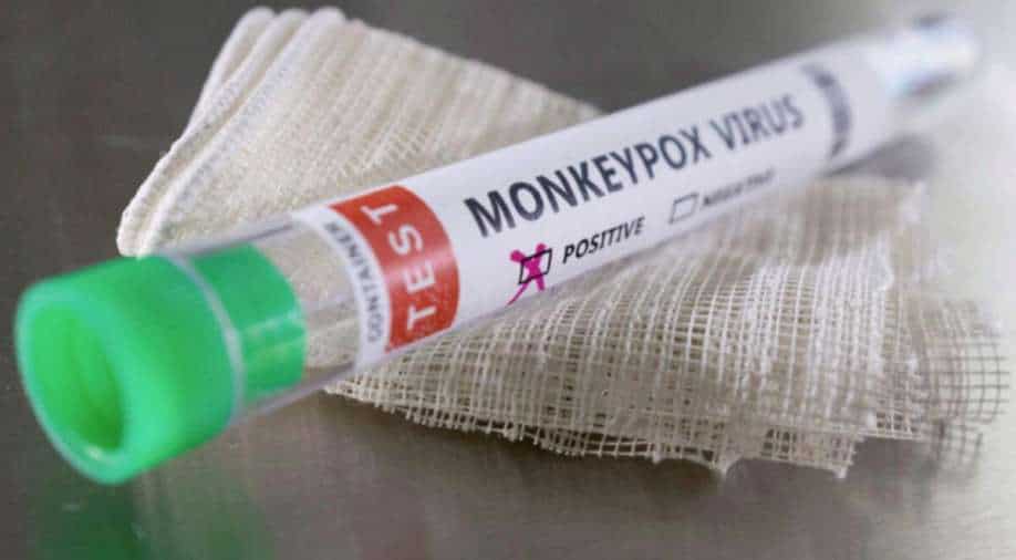 Man claims he had monkeypox and coronavirus at the same time - Vimarsana News