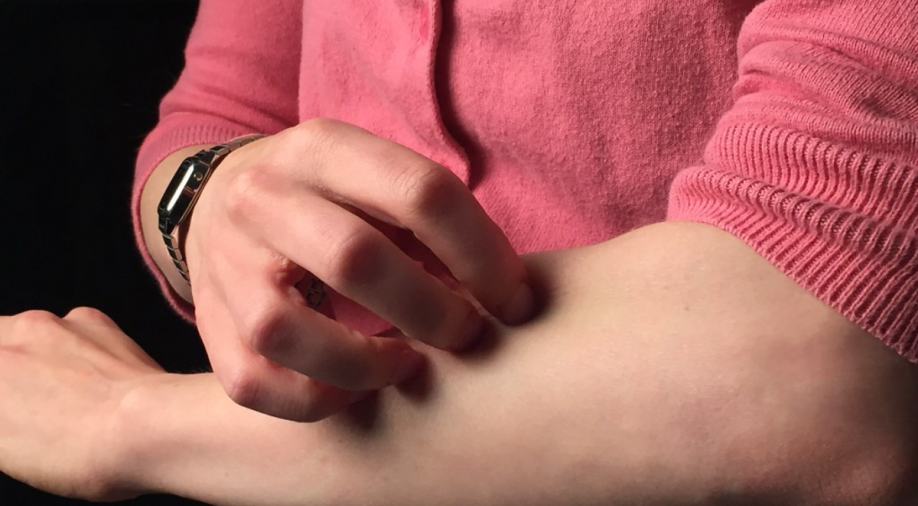 Scientists unravel why skin conditions like eczema lead to itching. New research says...